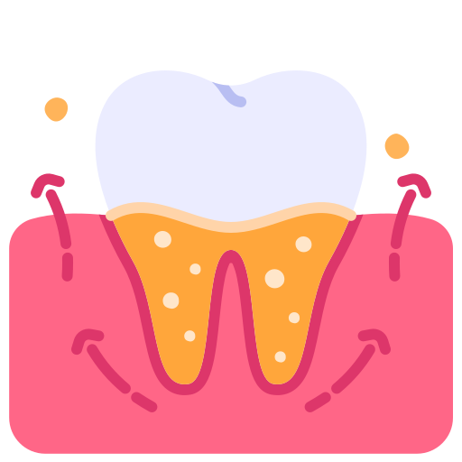 Scaling, Root Planing & Professional Teeth Cleaning